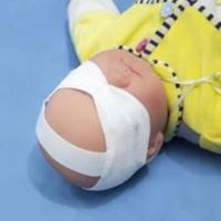 Baby phototherapy blindfold